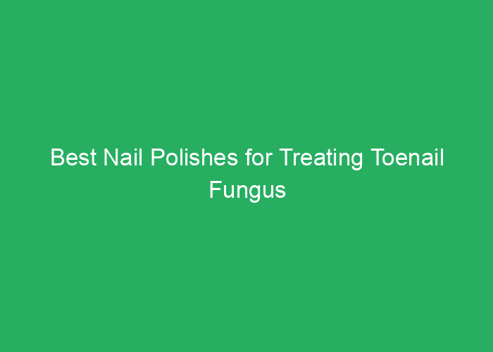 Best Nail Polishes for Treating Toenail Fungus
